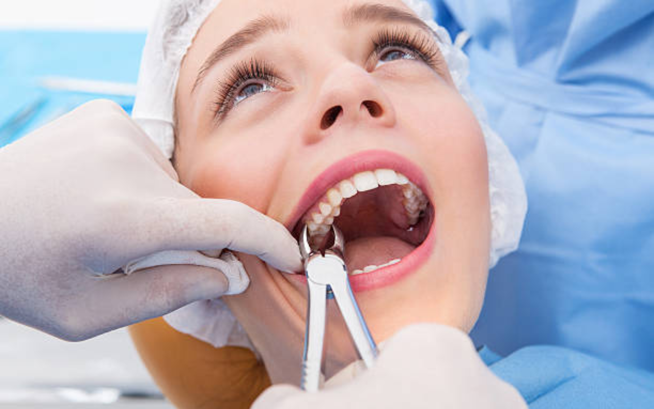 Tooth Extractions