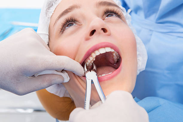 Tooth Extractions