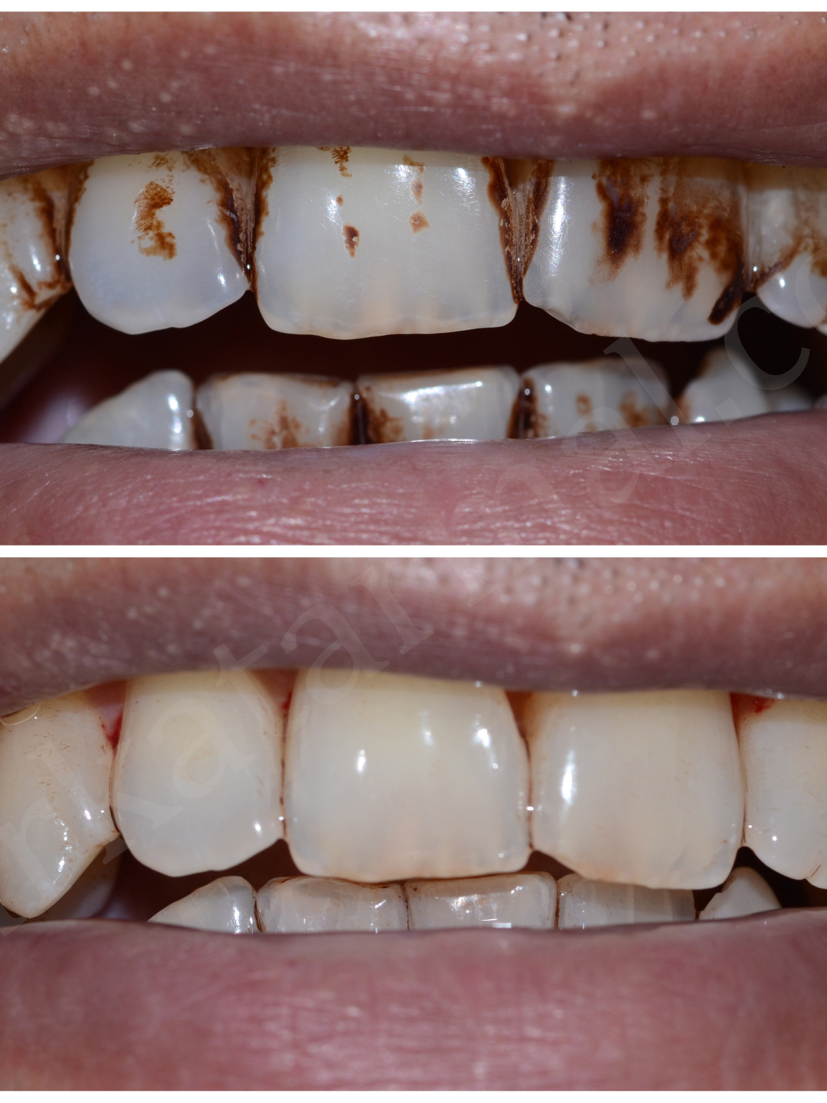 Delta Park Dental