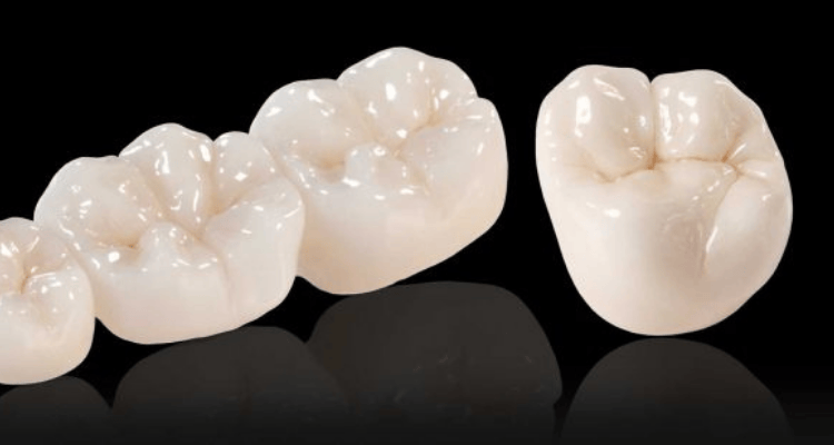 Porcelain Crowns