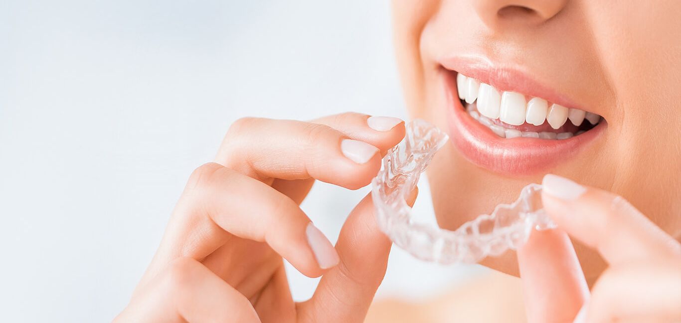 Invisalign