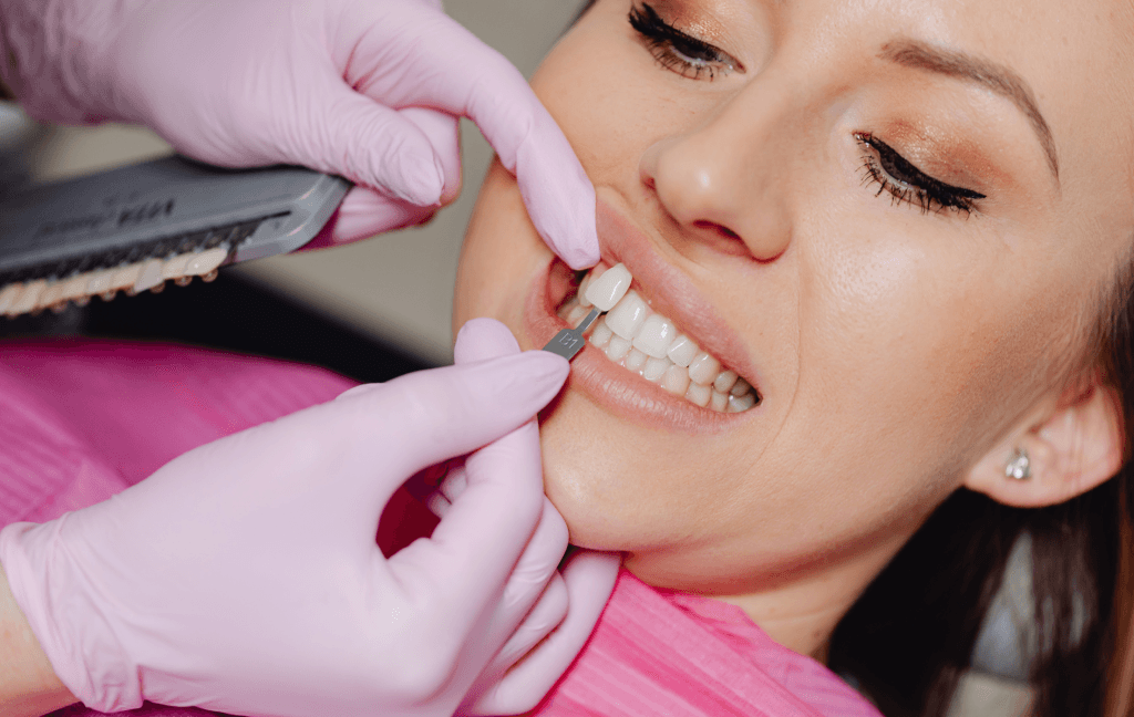 Dental Veneers Brampton