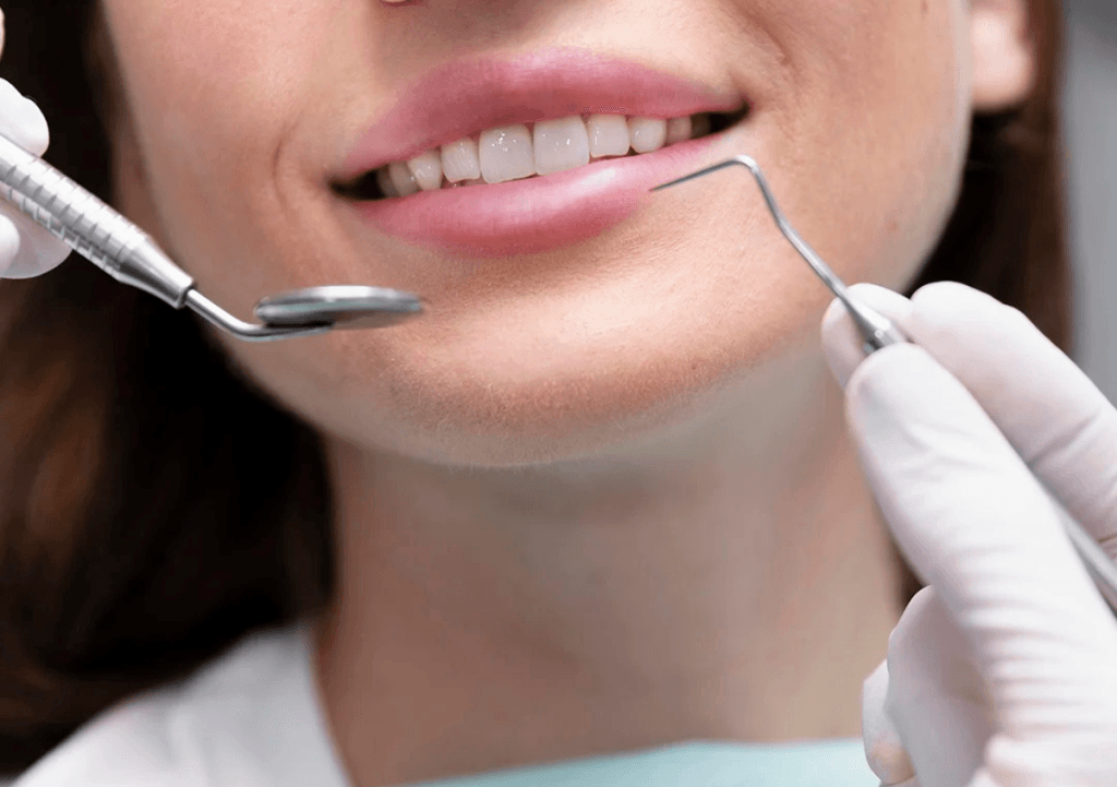 dental fillings in brampton