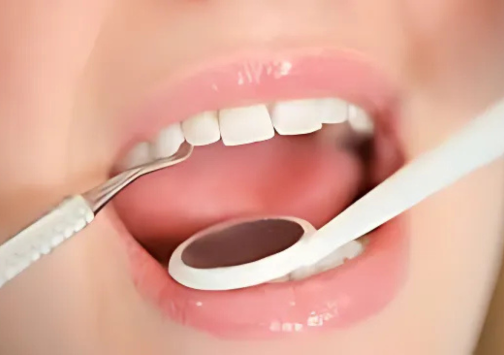 dental filling near me