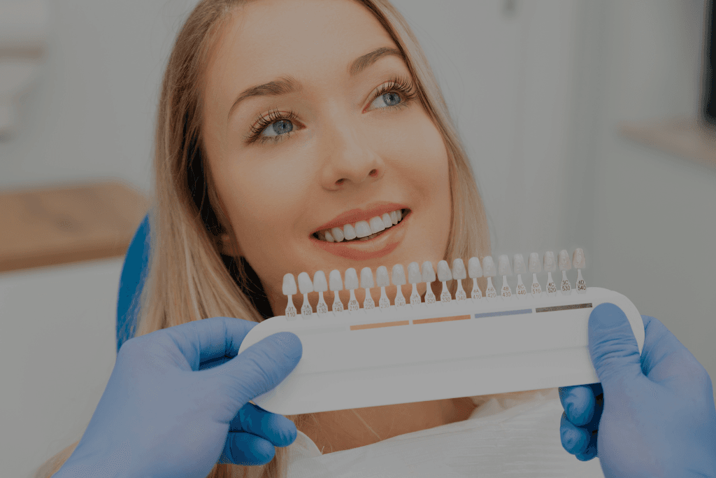 Dental Veneers 03