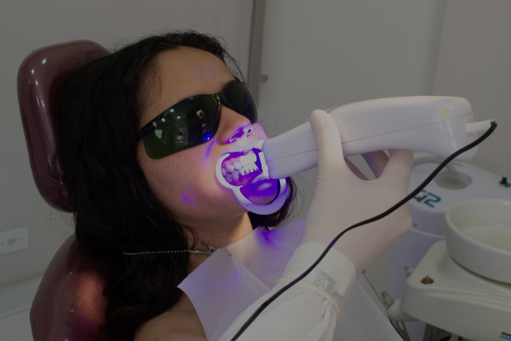 teeth whitening 01