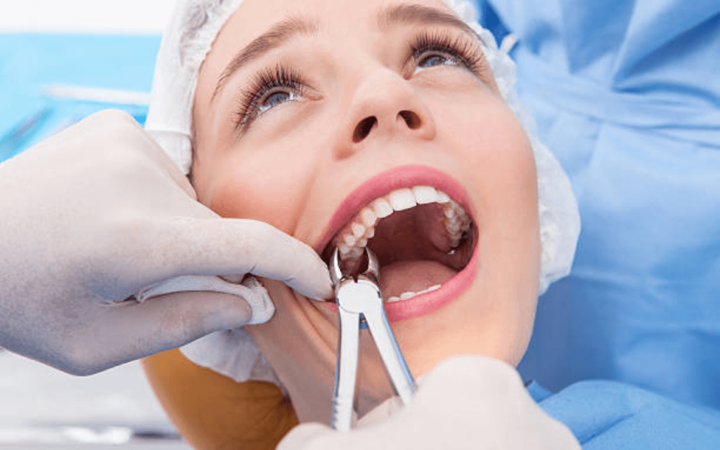 tooth extraction