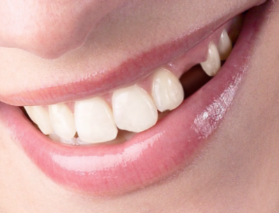 emergency dentistry woodhill 01