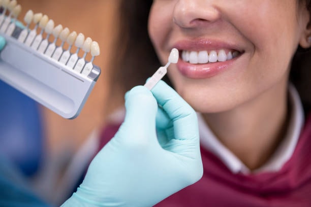 root canal treatment woodhill 03