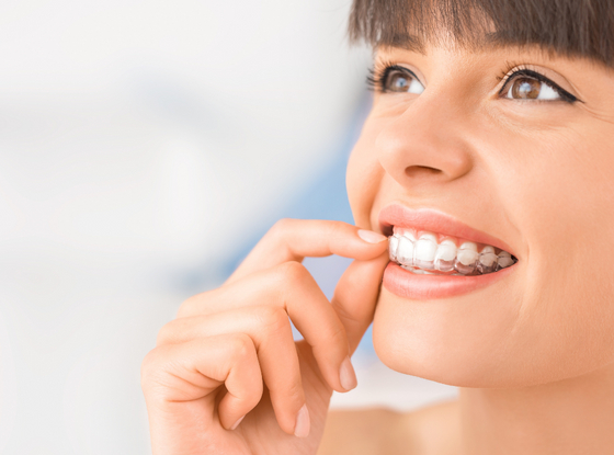Invisalign Dentist Near Me