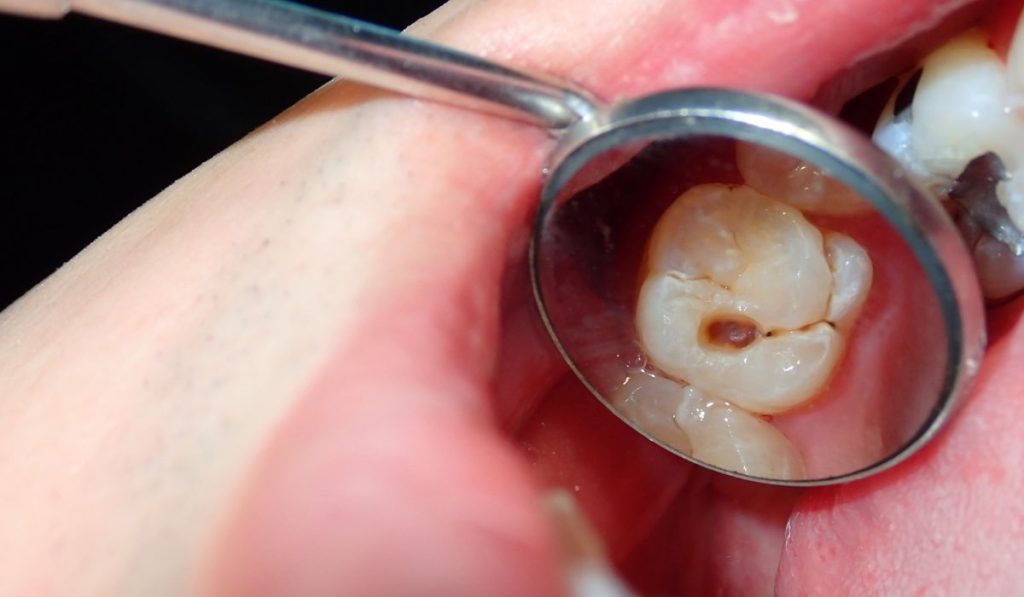 dental exams & teeth cleanings woodhill