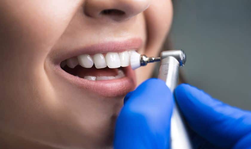 dental exams & teeth cleanings woodhill 01