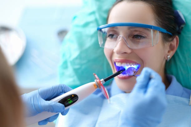 dental bondings