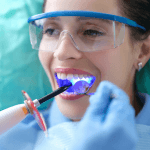 Composite Bonding Cost in Ontario: Per-Tooth Pricing and Coverage