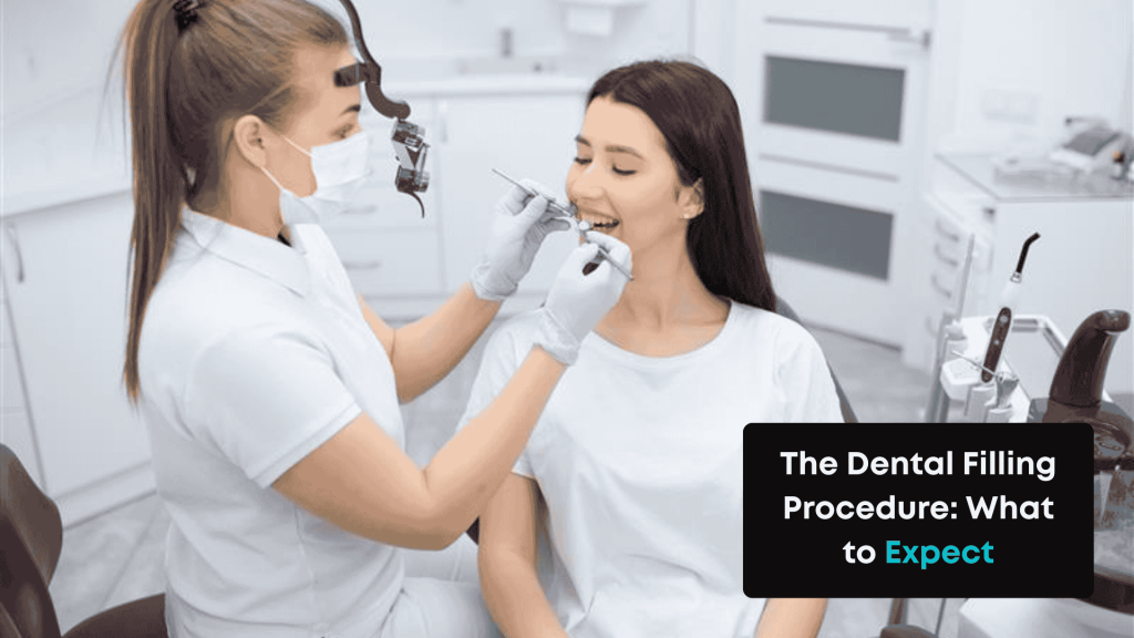 Dental Fillings