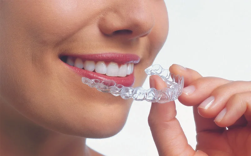 Invisalign Works
