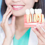 Disadvantages of Dental Implants: What to Weigh First