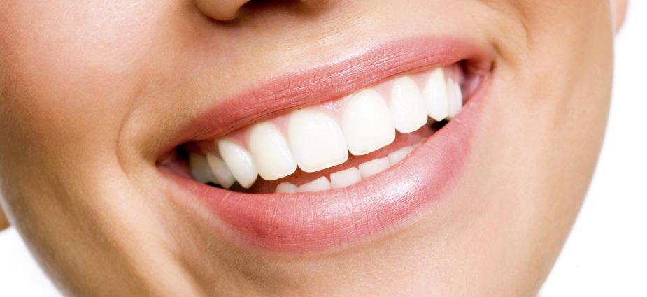 whiten teeth fast