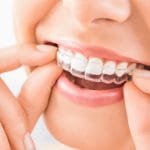 How to Use Cleaning Crystals for Invisalign?