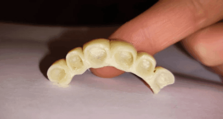 Temporary -Bridge-PLacement