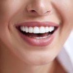 What Teeth Whitening Is Best?