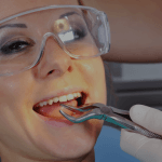 When to Stop Using Gauze After Wisdom Tooth Extraction?