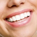 What is the best teeth whitening?