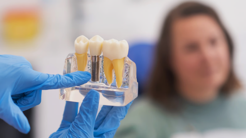 dental crown