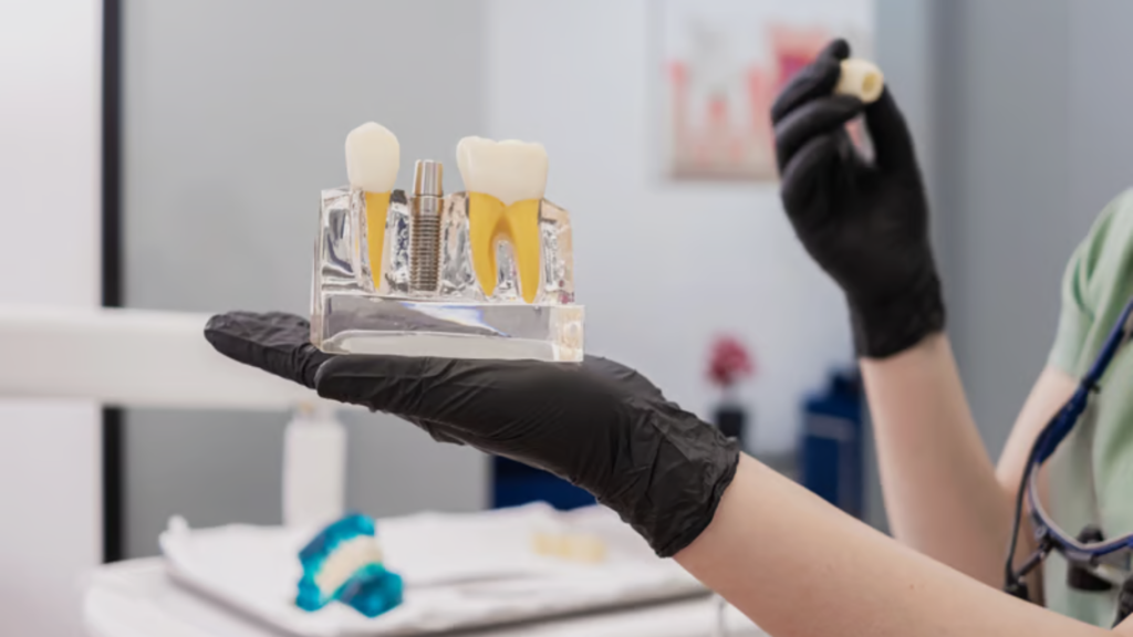 dental crown brampton