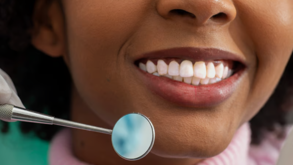 dental fillings