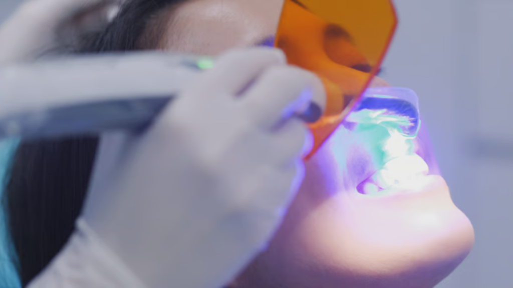 teeth whitening


