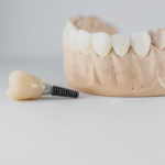 How long for dental implants to heal?