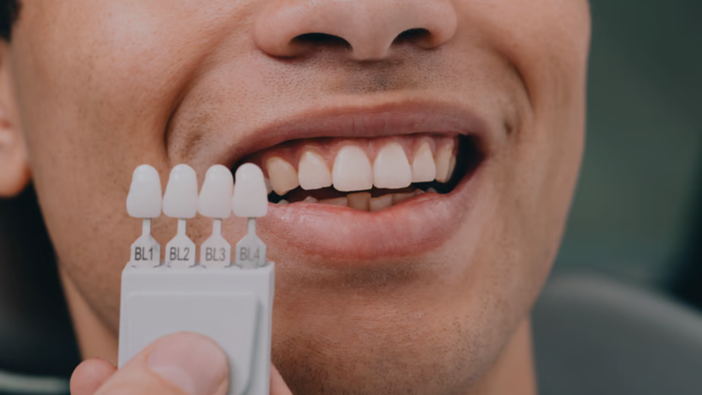Dental crowns