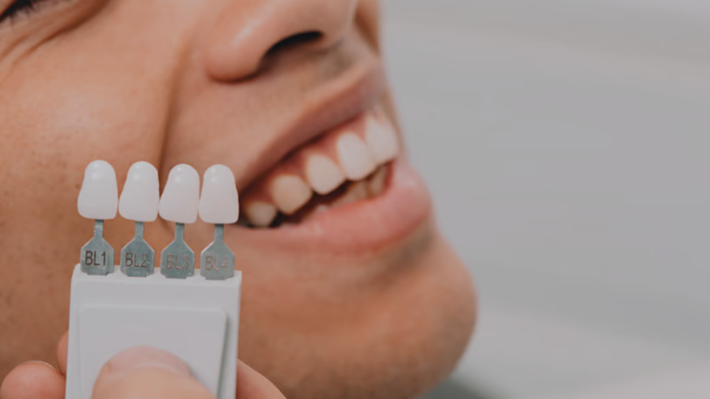 Dental crowns for teeth