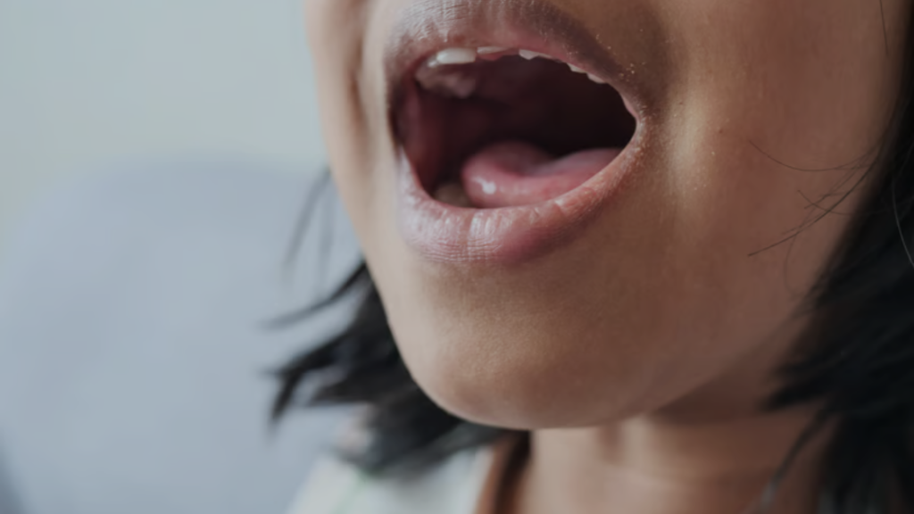 bad breath