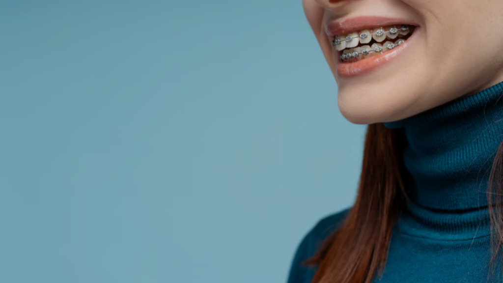braces