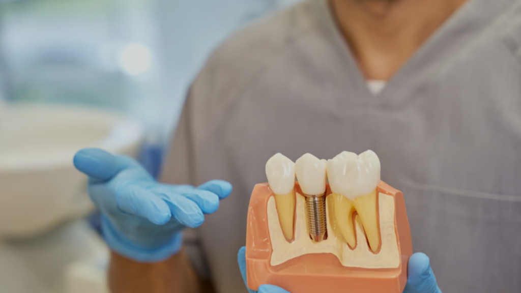 dental implant treatment in delta park dental