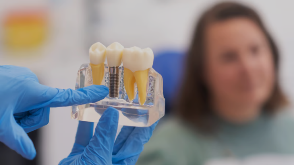 dental implants in brampton