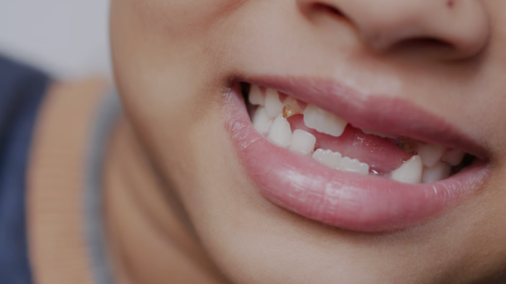 emergency in teeth