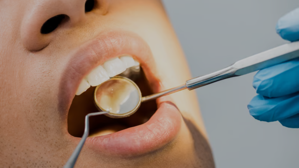 teeth filling