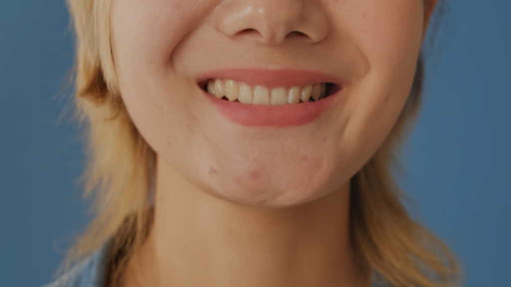 yellow teeth