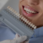 How Much Do Dental Veneers Cost in Ontario?