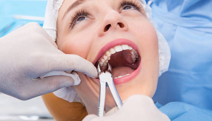 istockphoto-469056712-612×612 Tooth Extractions